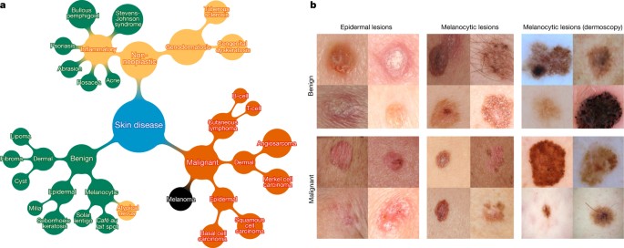 skin_cancer.jpg